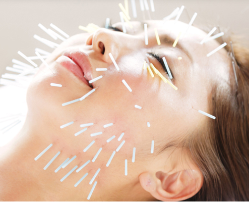 美容鍼のすすめ 伊藤はりマッサージサロン